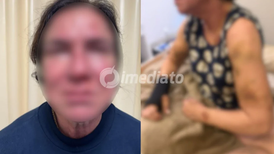 ‘Tive medo de ser morta’, diz mulher ao denunciar agressões do marido na véspera de Natal, em Manaus