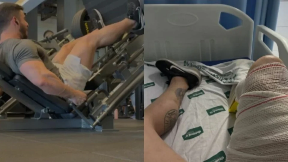 Chocante: Fisiculturista sofre rompimento de tendão durante treino com carga de 400 kg em Teresina
