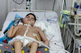 Mãe de adolescente acamado pede ajuda para comprar carrinho de churrasco e sustentar filho internado na UTI em Manaus