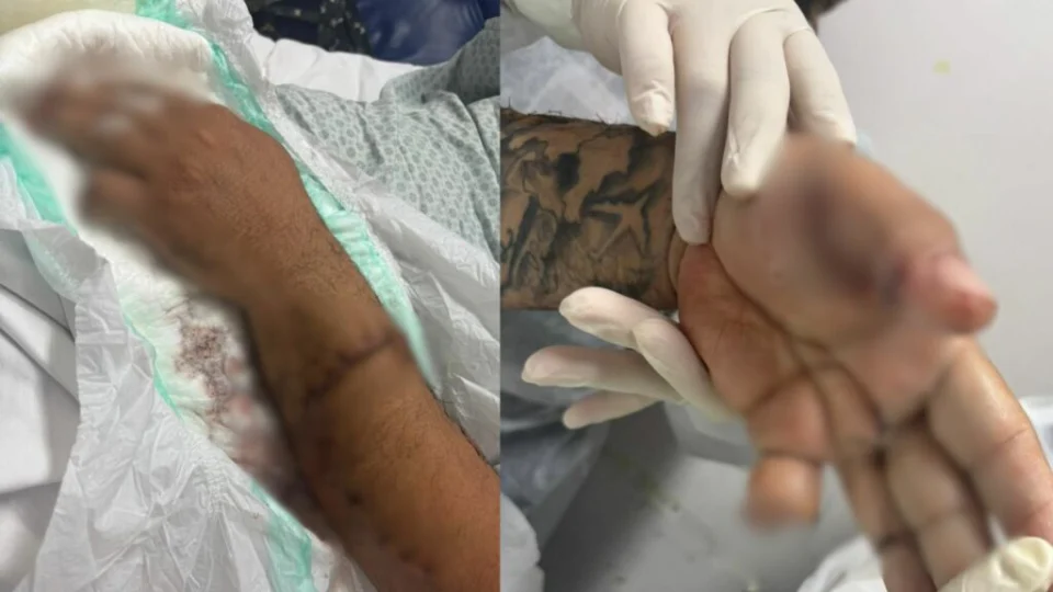 Motorista de aplicativo tem dedo amputado após ataque a terçadadas em Manaus