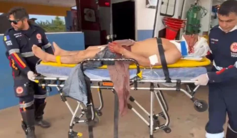 Homem aceita trabalho na zona rural e acaba golpeado com facão pelo ‘contratante’