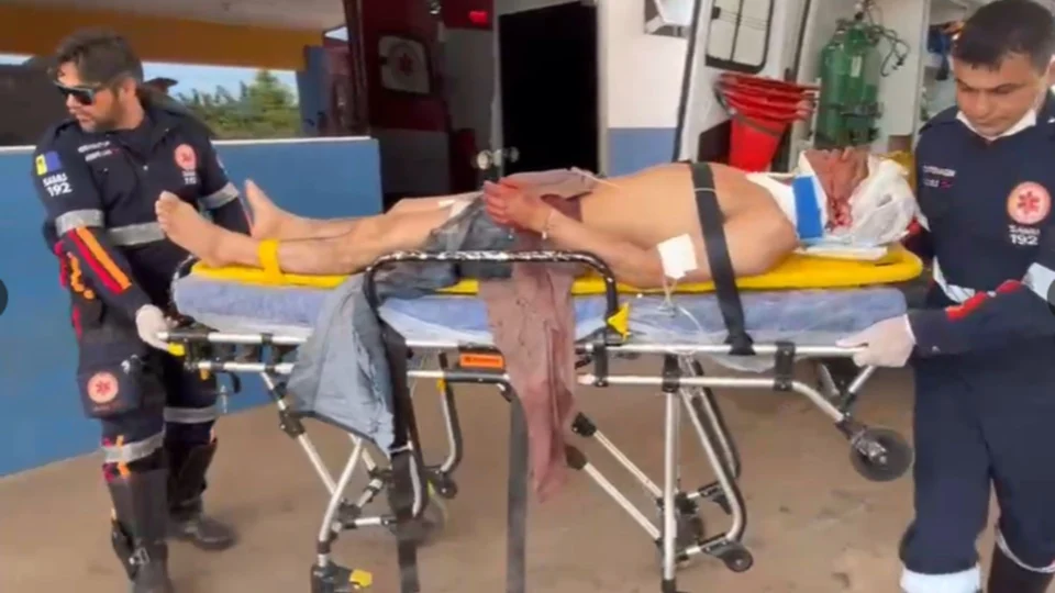 Homem aceita trabalho na zona rural e acaba golpeado com facão pelo ‘contratante’