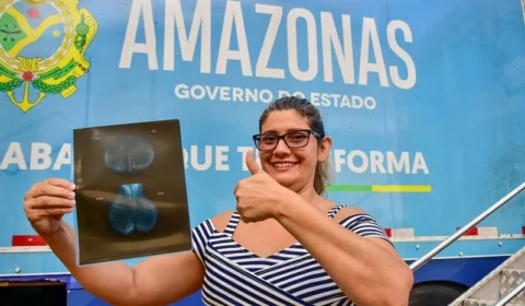 Governo do Amazonas oferta cirurgias e exames para mais de mil mulheres neste fim de semana