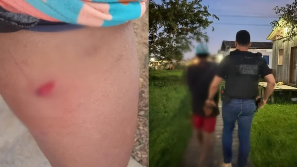 Homem é preso após atacar companheira com faca em Eirunepé