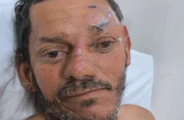 Hospital João Lúcio pede ajuda para localizar familiares de idoso atropelado em Manaus