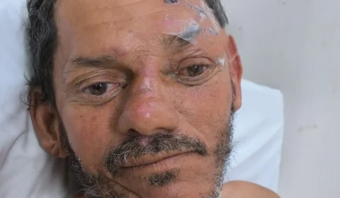 Hospital João Lúcio pede ajuda para localizar familiares de idoso atropelado em Manaus