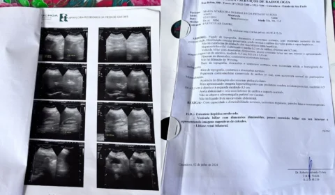 Moradora de Porto Velho espera há mais de 10 anos por cirurgia e denuncia falhas no sistema de saúde