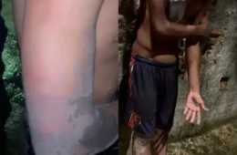 Três adolescentes são encontrados feridos após suposto “tribunal do crime” na Cabanagem, em Belém