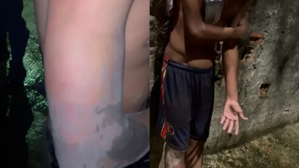 Três adolescentes são encontrados feridos após suposto “tribunal do crime” na Cabanagem, em Belém