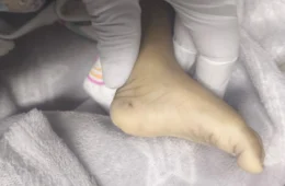 Imagens fortes: Bebê de 6 meses chega sem vida ao SPA Alvorada com marcas de violência; pais são presos em Manaus