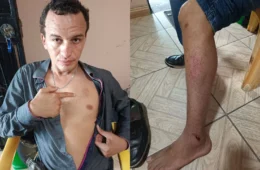 Cliente denuncia agressão após abordagem de seguranças em supermercado no bairro Compensa