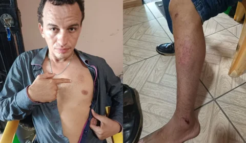 Cliente denuncia agressão após abordagem de seguranças em supermercado no bairro Compensa