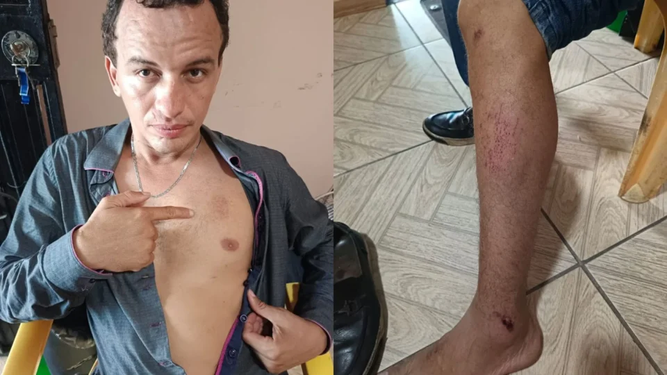 Cliente denuncia agressão após abordagem de seguranças em supermercado no bairro Compensa