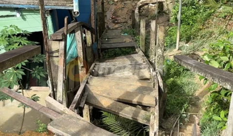 Vídeo: Queda em escada precária termina com amputação de morador na zona Norte de Manaus
