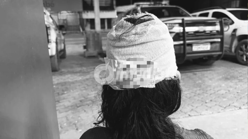 CENA FORTE: Mulher é brutalmente agredida pelo companheiro e leva mais de 50 pontos no rosto em Manaus
