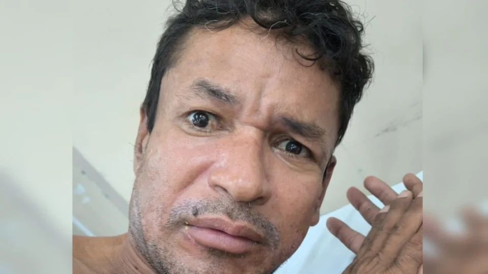 Hospital João Lúcio procura familiares de paciente atropelado em Manaus