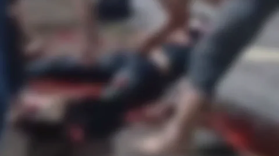 VEJA VÍDEO: motociclista fica com perna esmagada após bater de frente com carro