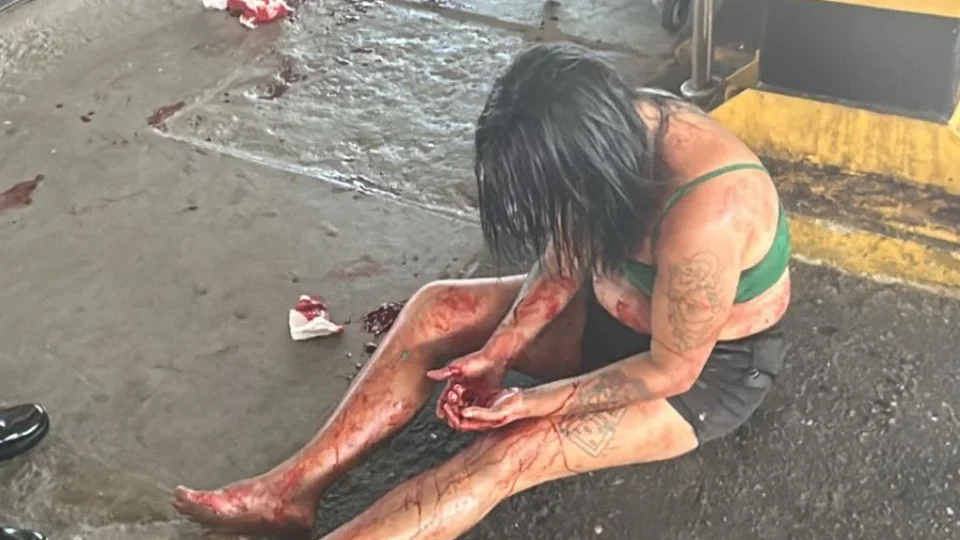 Confusão termina em esfaqueamento no bairro do Jurunas, em Belém.