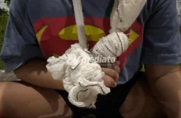 VEJA FOTOS: Criança de 4 anos tem dedo decepado enquanto brincava em praça sem manutenção no bairro Nova Cidade