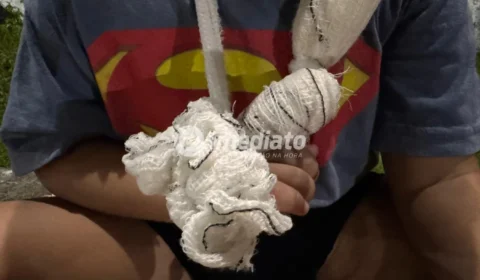 VEJA FOTOS: Criança de 4 anos tem dedo decepado enquanto brincava em praça sem manutenção no bairro Nova Cidade