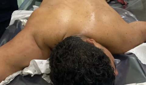 Veja como ficou suspeito baleado após tentar tomar arma de PM durante abordagem em Iranduba