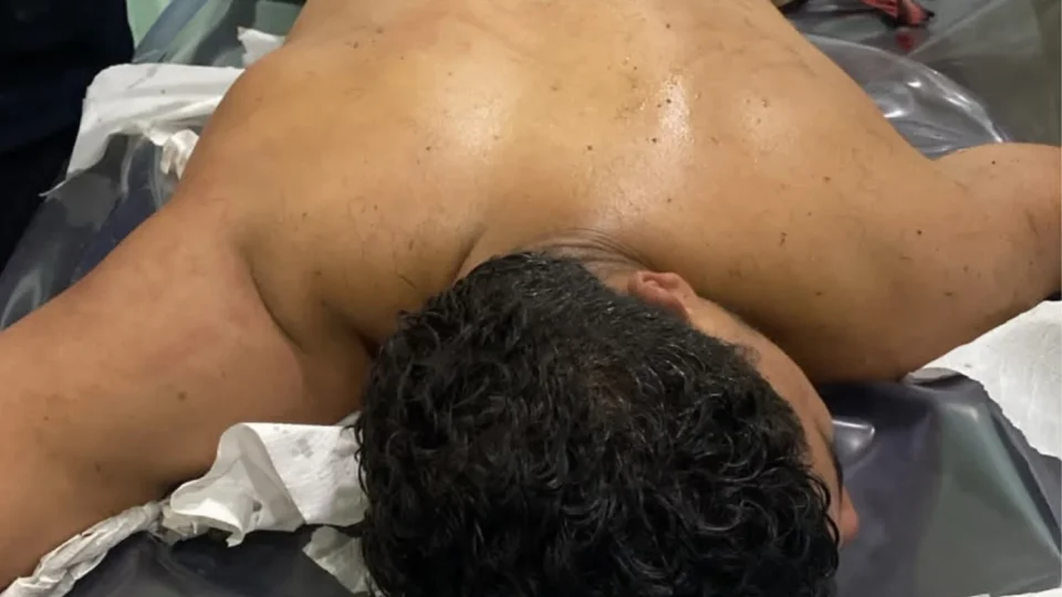 Veja como ficou suspeito baleado após tentar tomar arma de PM durante abordagem em Iranduba