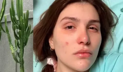 ALERTA: Influenciadora sofre queimadura nos olhos com planta popularmente chamada de cacto-candelabro