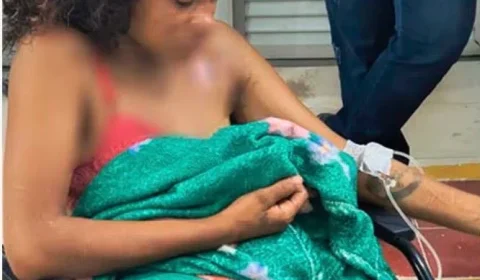 MALDADE | Mulher fica ferida após cunhada jogar óleo quente durante briga familiar em Santarém