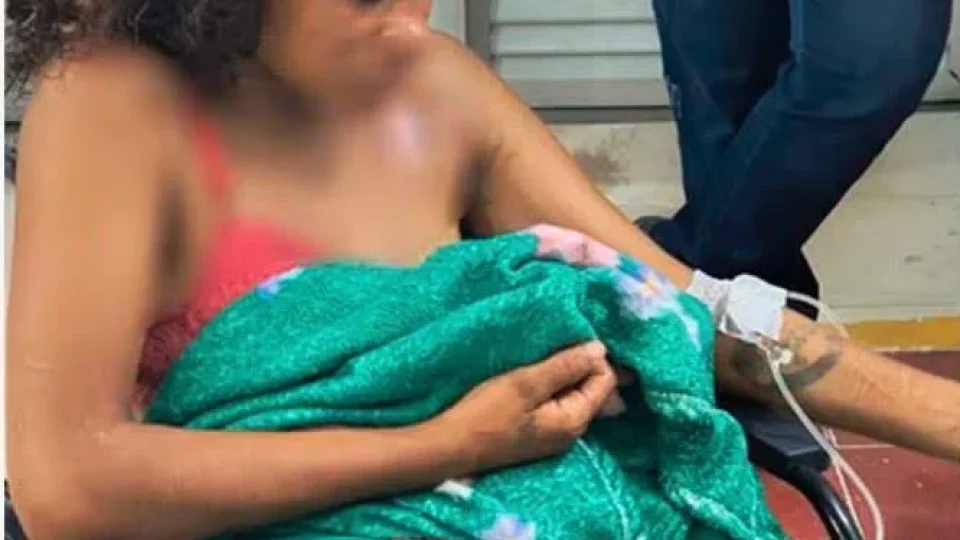 MALDADE | Mulher fica ferida após cunhada jogar óleo quente durante briga familiar em Santarém