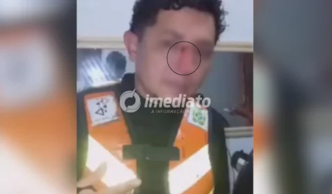 VEJA VÍDEO: Mototaxista tem rosto cortado por linha de papagaio durante corrida em Tefé e cobra fiscalização