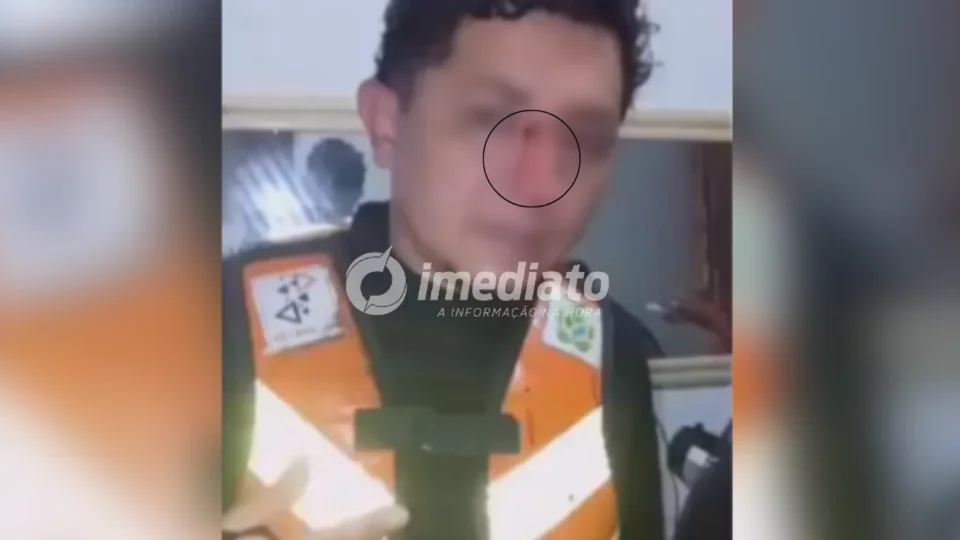 VEJA VÍDEO: Mototaxista tem rosto cortado por linha de papagaio durante corrida em Tefé e cobra fiscalização