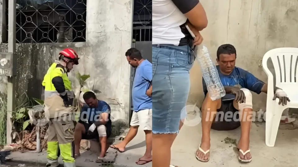 VEJA FOTOS: Avô sofre queimaduras ao tentar salvar crianças de 10 meses e 2 anos que morreram carbonizadas em incêndio no Tarumã