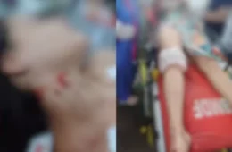ATAQUE BRUTAL: Homem arromba casa, espera companheira chegar e tenta matá-la a facadas no Distrito Federal