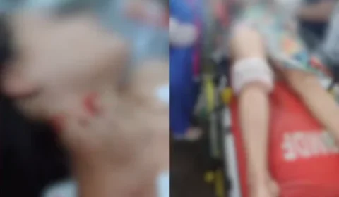 ATAQUE BRUTAL: Homem arromba casa, espera companheira chegar e tenta matá-la a facadas no Distrito Federal