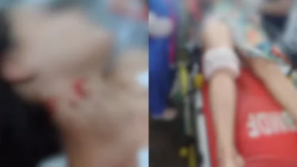 ATAQUE BRUTAL: Homem arromba casa, espera companheira chegar e tenta matá-la a facadas no Distrito Federal