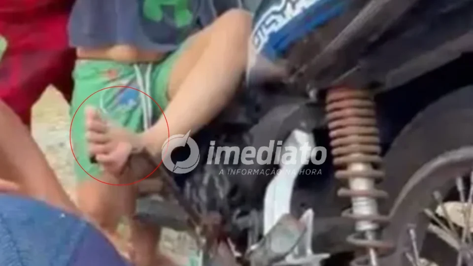 VEJA VÍDEO: Criança de 4 anos fica ferida após pé ser perfurado por pedal de moto no interior do Amazonas