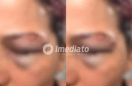 BARBARIDADE: Mulher denuncia ex-companheiro após ser agredida dentro de casa em Manaus