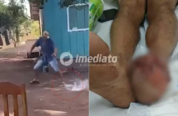 VEJA VÍDEO: Homem perde todos os dedos do pé após tentar conter explosão de ‘catolé’ com pisão