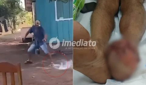 VEJA VÍDEO: Homem perde todos os dedos do pé após tentar conter explosão de ‘catolé’ com pisão