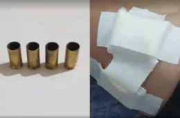 Jovem é baleado no peito durante ataque a tiros em Boa Vista