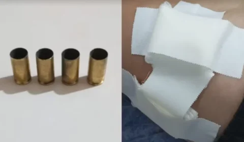 Jovem é baleado no peito durante ataque a tiros em Boa Vista