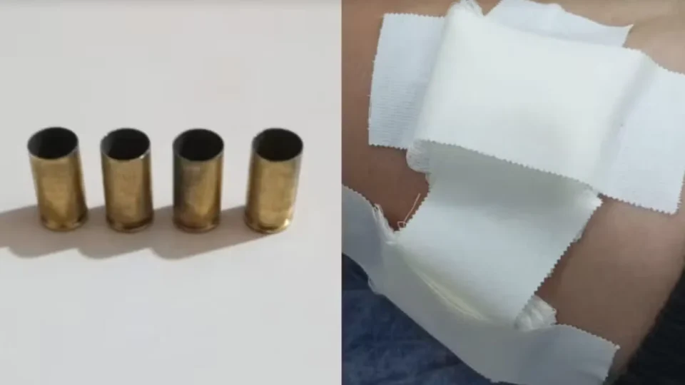 Jovem é baleado no peito durante ataque a tiros em Boa Vista