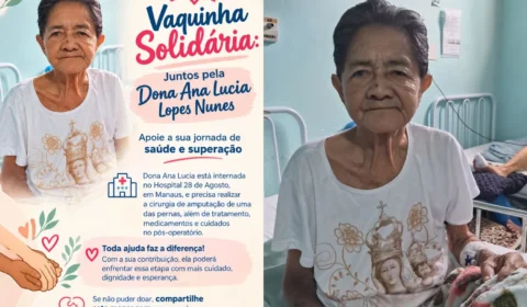 Família faz vaquinha solidária para custear tratamento e cirurgia de amputação de Dona Ana Lucia em Manaus