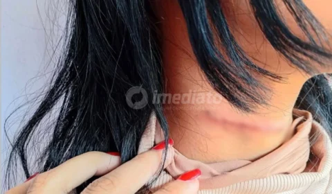 IMAGENS FORTES: Adolescente é ferida no pescoço durante tentativa de assalto em frente a escola em Manaus
