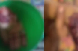 IMAGENS FORTES | Com garrafa de cachaça e terçado, homem é preso após quase decepar mão de mulher no Pará
