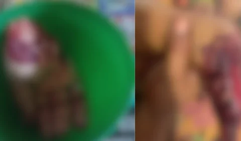 IMAGENS FORTES | Com garrafa de cachaça e terçado, homem é preso após quase decepar mão de mulher no Pará