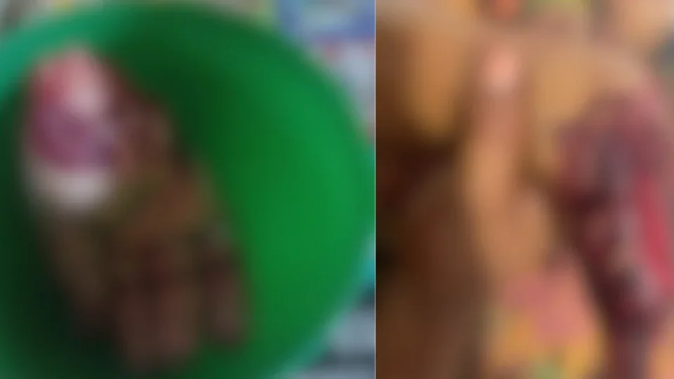 IMAGENS FORTES | Com garrafa de cachaça e terçado, homem é preso após quase decepar mão de mulher no Pará