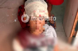 IMAGENS FORTES | Mulher sofre múltiplos golpes de faca em tentativa de feminicídio
