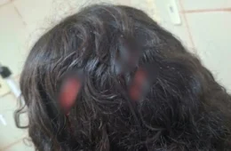 BRIGA EM ESCOLA| Estudante de 13 anos é apreendido após esfaquear colega