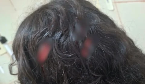 BRIGA EM ESCOLA| Estudante de 13 anos é apreendido após esfaquear colega